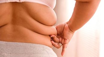 México registra más casos de obesidad entre mujeres