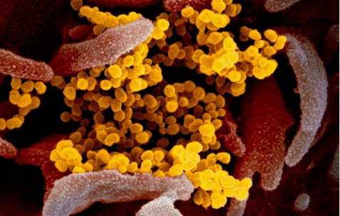 Estas son las imágenes microscópicas del coronavirus Covid-2019 - José Cárdenas